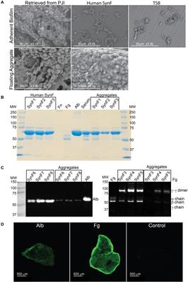 Staphylococcus aureus Floating Biofilm Formation and Phenotype in Synovial Fluid Depends on Albumin, Fibrinogen, and Hyaluronic Acid